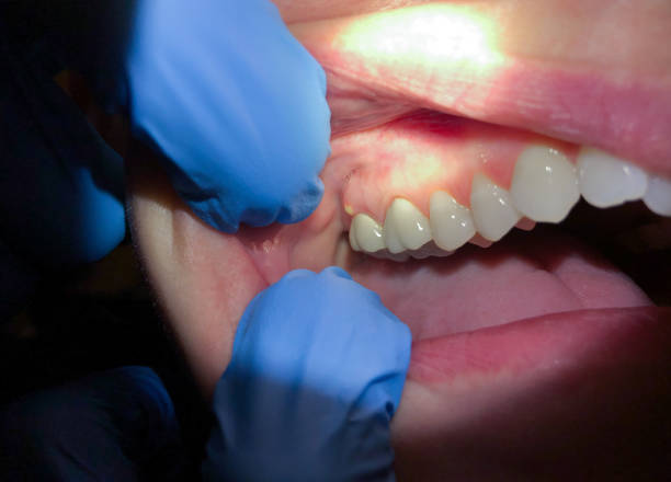 Best Cosmetic Emergency Dentistry in Bon Secour, AL